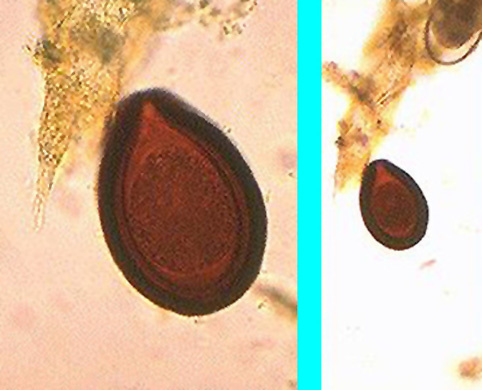 eimeria leuckarti (Eq)