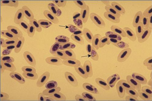 plasmodium relictum2 (Av)